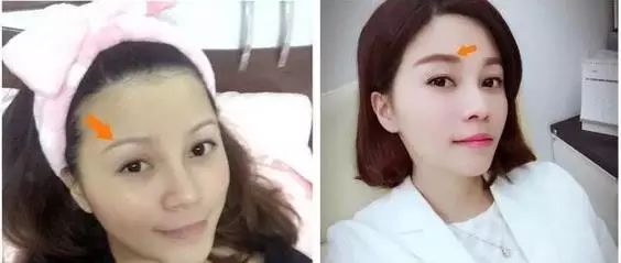 紋眉手法好的視頻教程_視頻紋眉教材_紋眉視頻初學(xué)者